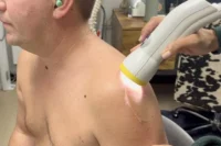 Softwave treatment in St. Petersburg Florida