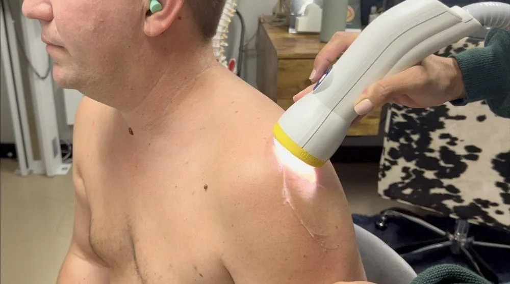 Softwave treatment in St. Petersburg Florida